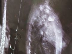 -张钰强中医正骨推拿连锁(华发商都店)