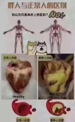 -香薇妮丝女子减肥院
