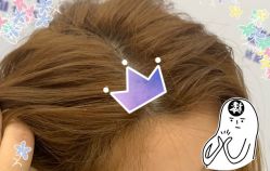 -大麦微针植发全国连锁