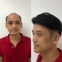 -发饰美男士增发补发假发定制店