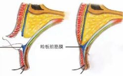 -丰联丽格医疗美容·联合丽格眼整形中心
