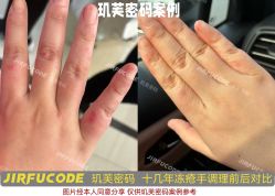 -元熙兰积皮肤管理