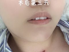 -上海市静安区闸北中心医院