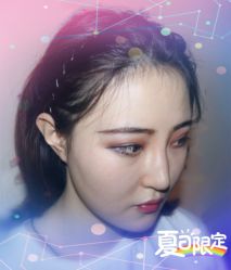 -大麦微针植发全国连锁