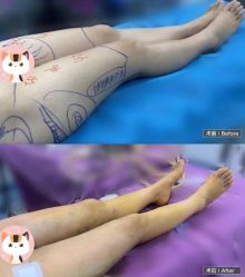 -恒博天姿医疗美容