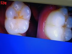 -土豆口腔(凤凰北总店)