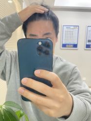 -大麦微针植发丨全国连锁