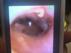 -铭洋专业采耳(田子坊店)