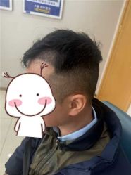 -大麦微针植发丨全国连锁