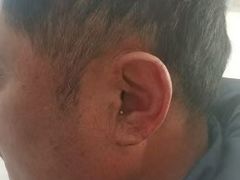-自然之声助听器(平凉店)