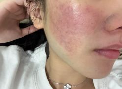 点击看大图 -深圳美莱医疗美容医院