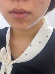 -长沙雅美医疗美容医院