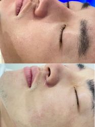 体验前-慕颜医疗美容·皮肤微整 抗衰