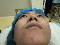 体验前-上海伊莱美医疗美容医院