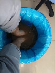 -德哥灰指甲脚气甲沟炎跖疣护理
