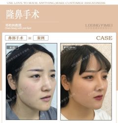 -北京丽星翼美医疗美容