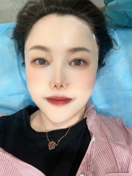 体验后-北京炫美医疗美容
