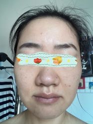 体验后-重庆军科整形美容医院