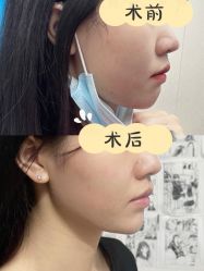-成都艾特他整形外科医院