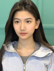 点击看大图 -杨益美学·野生眉半永久纹眉发际线