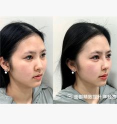 -上海伊莱美医疗美容医院