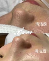 -LUNA皮相美·骨相美高级美感