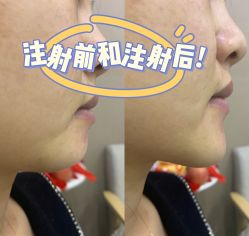 -和颜一美轻医美连锁