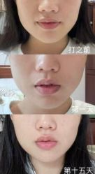 -石家庄苏亚美联臣医疗美容医院