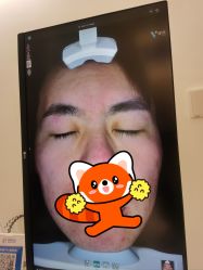 体验前-张小熊连锁轻医美