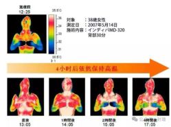 -半岛故事·法儿曼抗衰·indiba中心