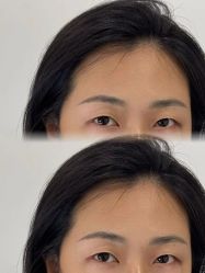 点击看大图 -张小野·专业半永久纹眉