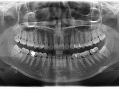 -耀光牙科(南园店)