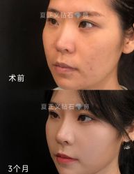 -北京米扬丽格医疗美容·联合丽格鼻整形中心