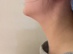 -四川米兰柏羽医学美容医院