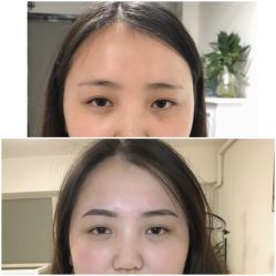 点击看大图 -Doris多里斯半永久纹眉·SMP纹发·发际线