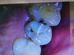 -深圳乐孚正强口腔诊所(宝体店)