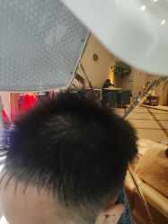 -碧莲盛·不剃发植发