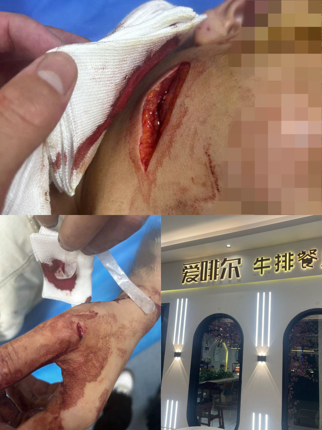 这家餐厅服务员汪雨鑫8月28号晚上拿刀砍人