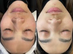 -LUNA皮相美·骨相美高级美感
