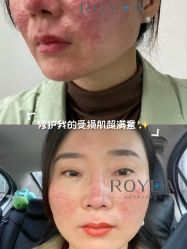 -ROYEA茹彦祛痘·问题肌肤修护中心