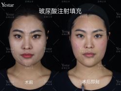 -Yestar艺星医疗美容医院