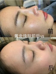 点击看大图 -SKIN79皮肤管理中心
