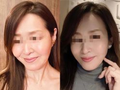 -素美医疗美容·西南眼鼻整形·修复基地