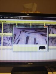 -菩叶头皮抗衰养发护发