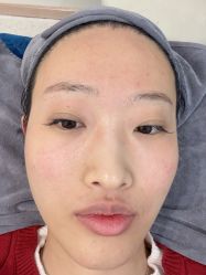 -More摩尔医美の注射线雕光电中心