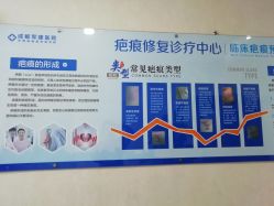 -成都军建医院·疤痕诊疗中心