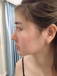 -素美医疗美容·西南眼鼻整形·修复基地