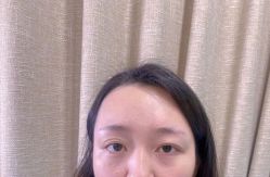 点击看大图 体验前-重庆联合丽格第五医疗美容医院