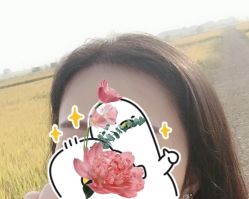 -大麦微针植发全国连锁