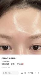 -MLP美丽派·问题肌疗愈中心